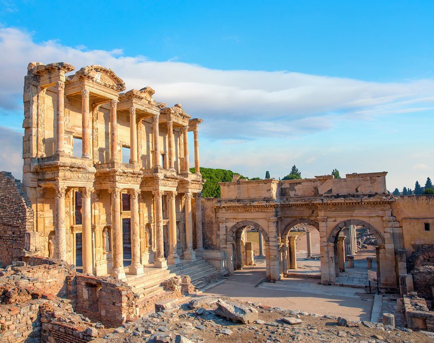 Hair Transplant Antalya Experience