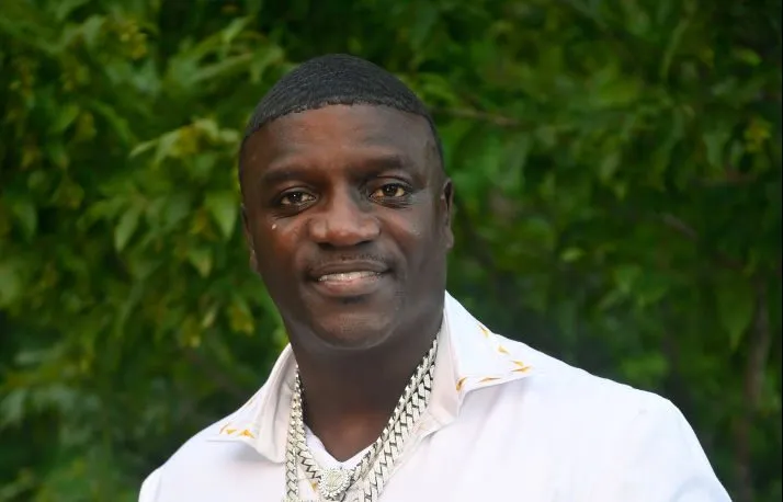 Akon Hair Transplant