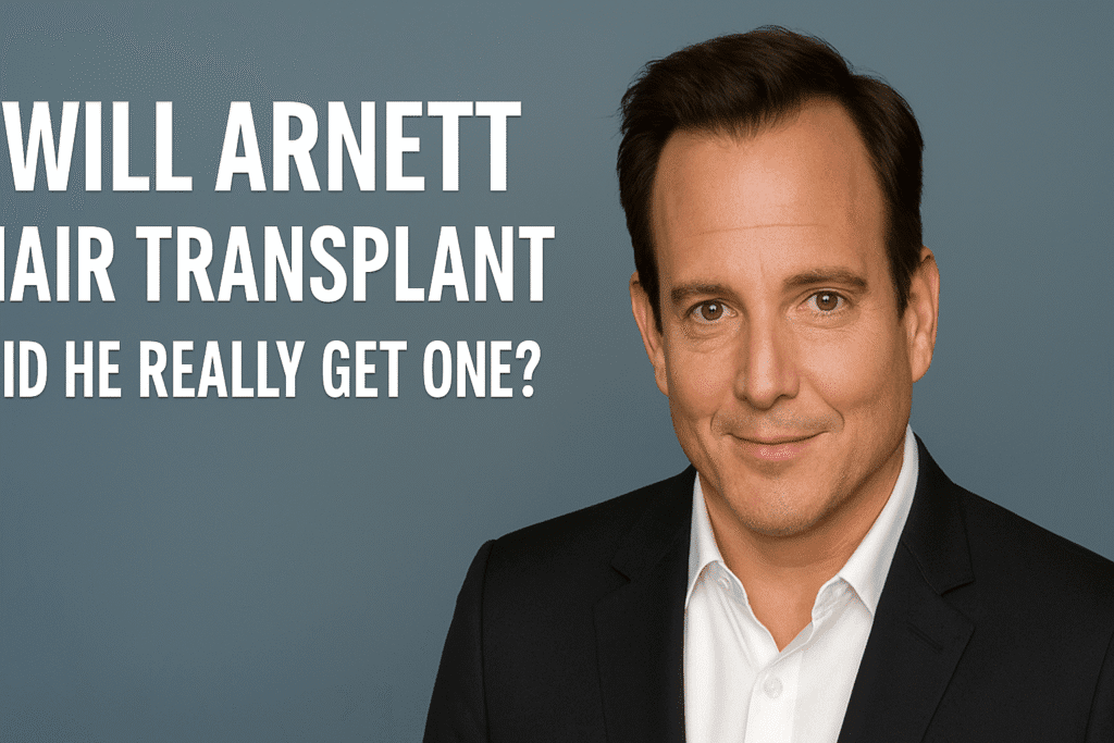 Will Arnett Hair Transplant