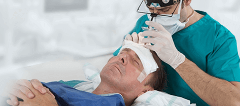 Hair Transplant with Sedation in Antalya