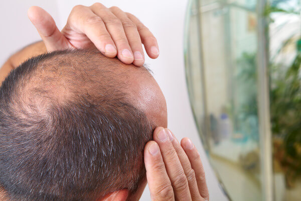 Why Is My Hair So Thin I Can See My Scalp? Causes & Solutions