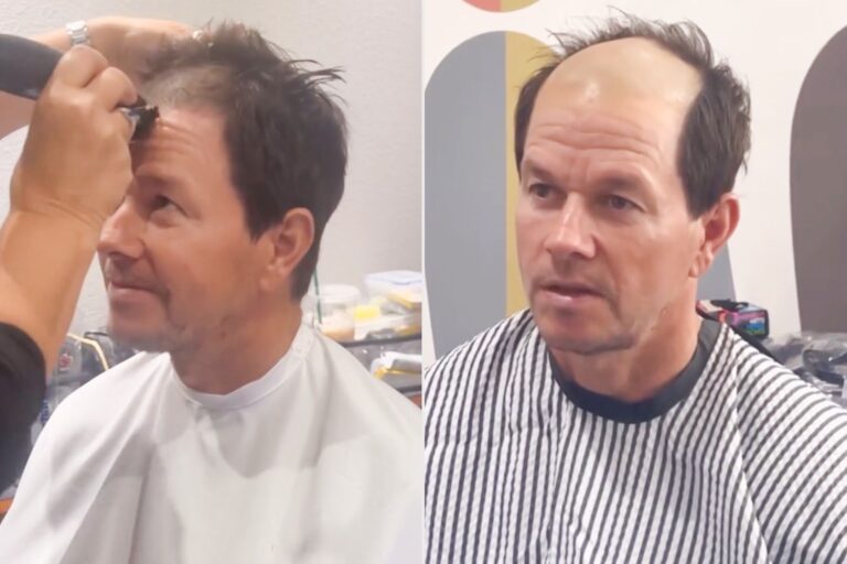 Mark Ravin Hair 20 Hollywood Actors With Receding Hairline: From Charm to Change ...