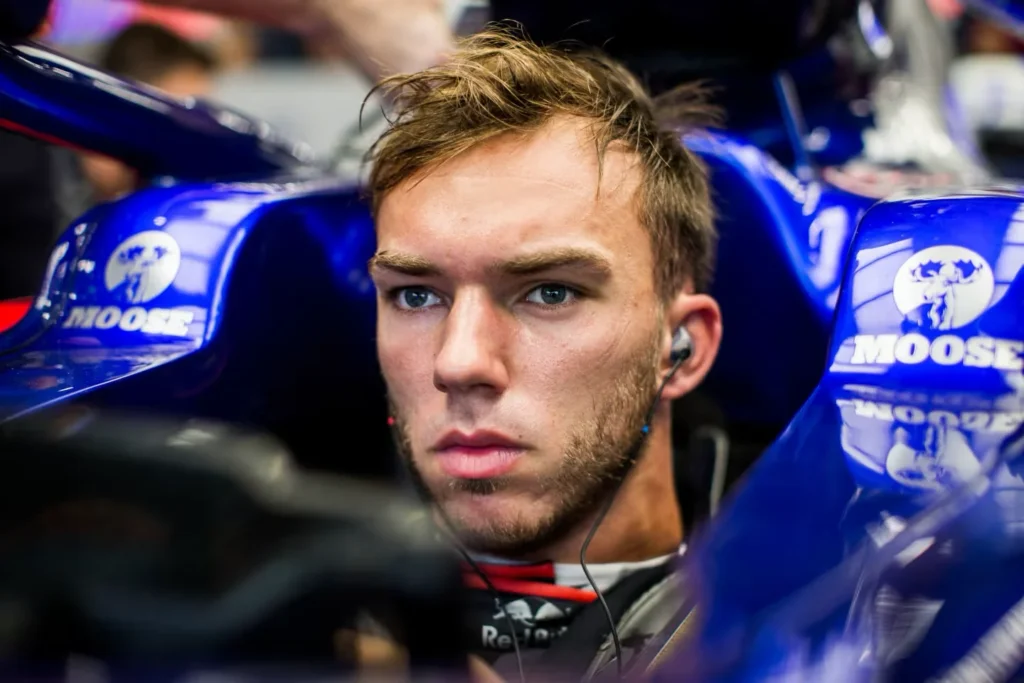 Pierre Gasly Hair Transplant
