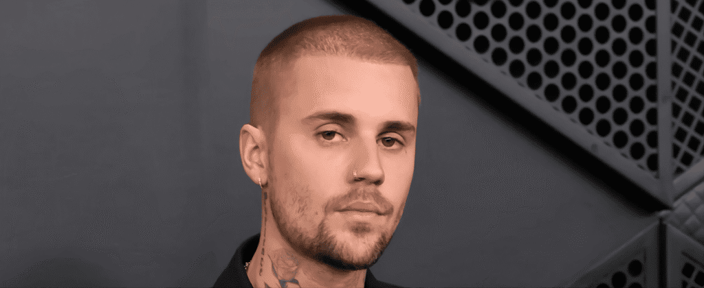 Did Justin Bieber Get a Hair Transplant?