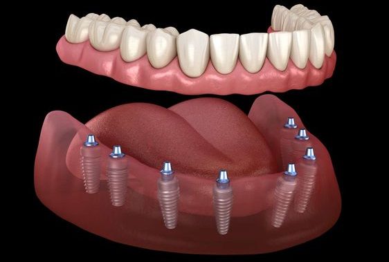 041ee3128b0e8421bb21e3e45aaad481-e1728040521705