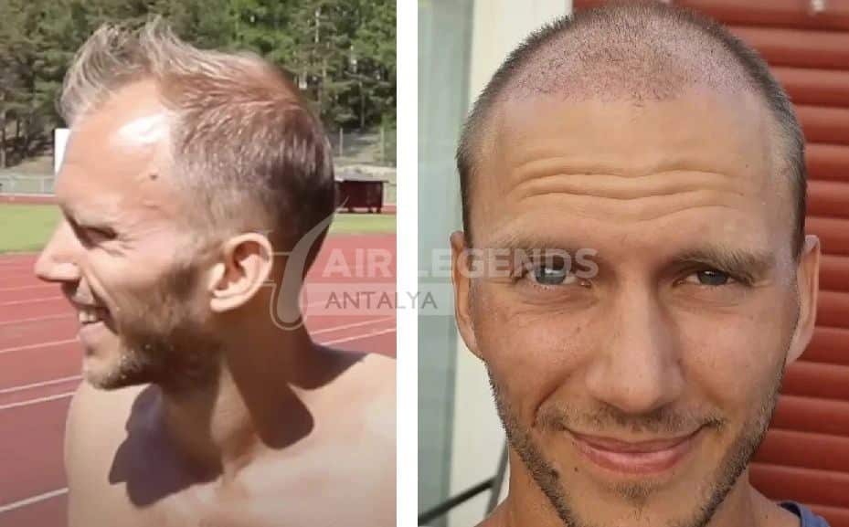 Shock Loss vs Permanent Growth