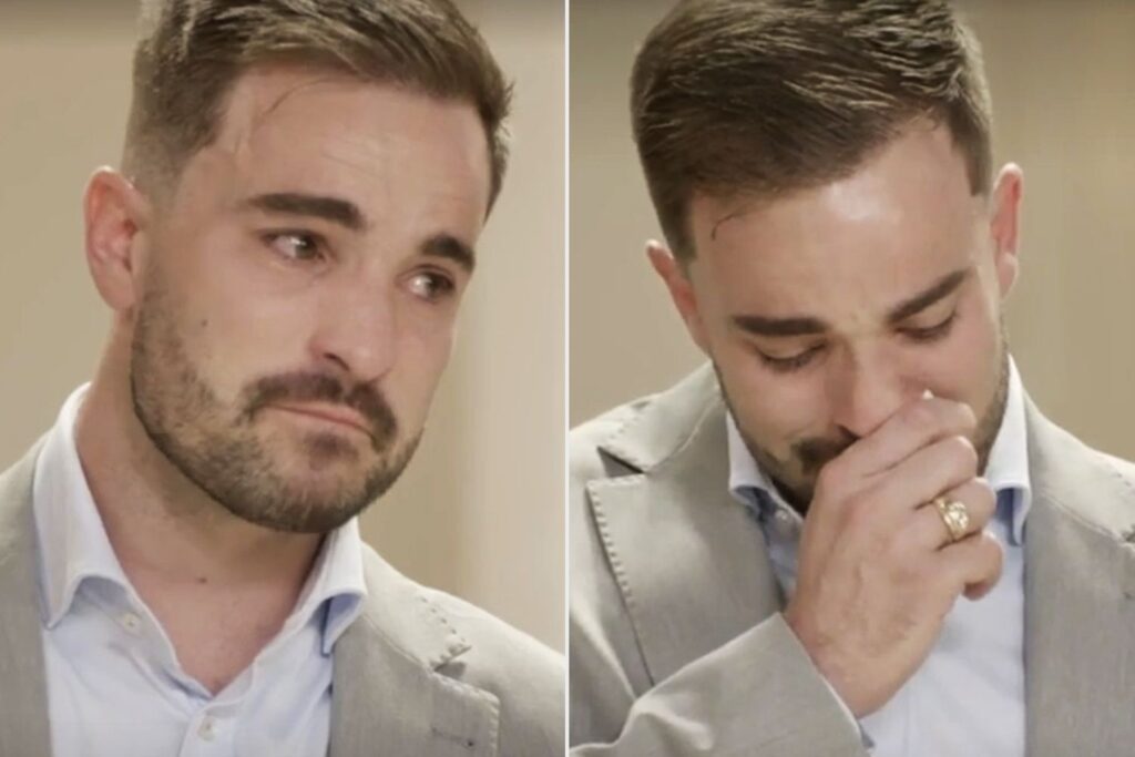 Connor Leavitt Hair Transplant Transformation