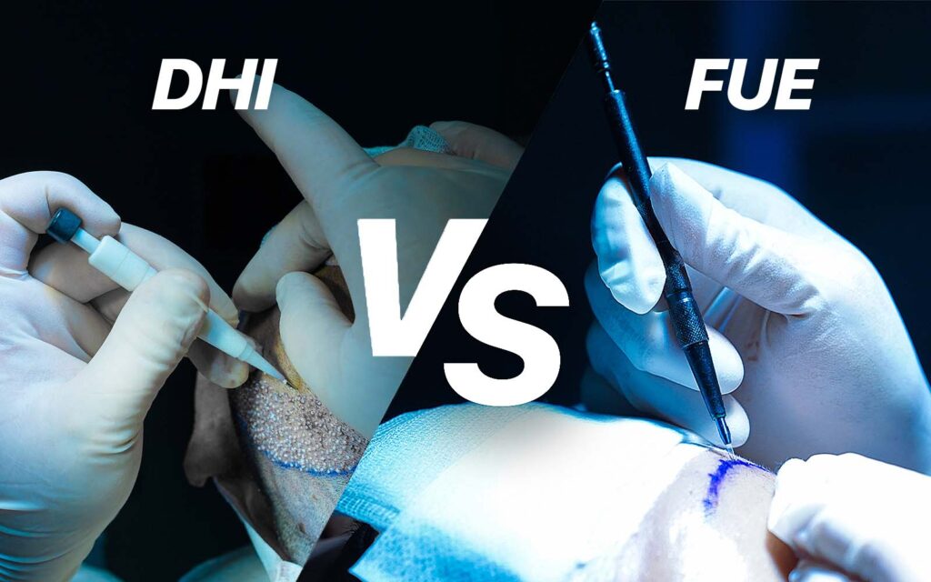 Sapphire FUE vs DHI comparison