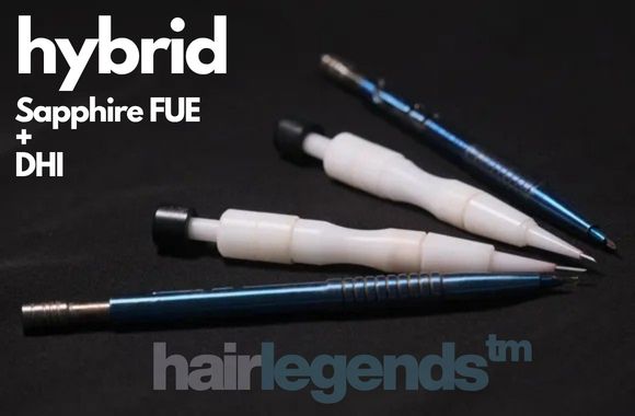 Why Hybrid Hair Transplant is Best?