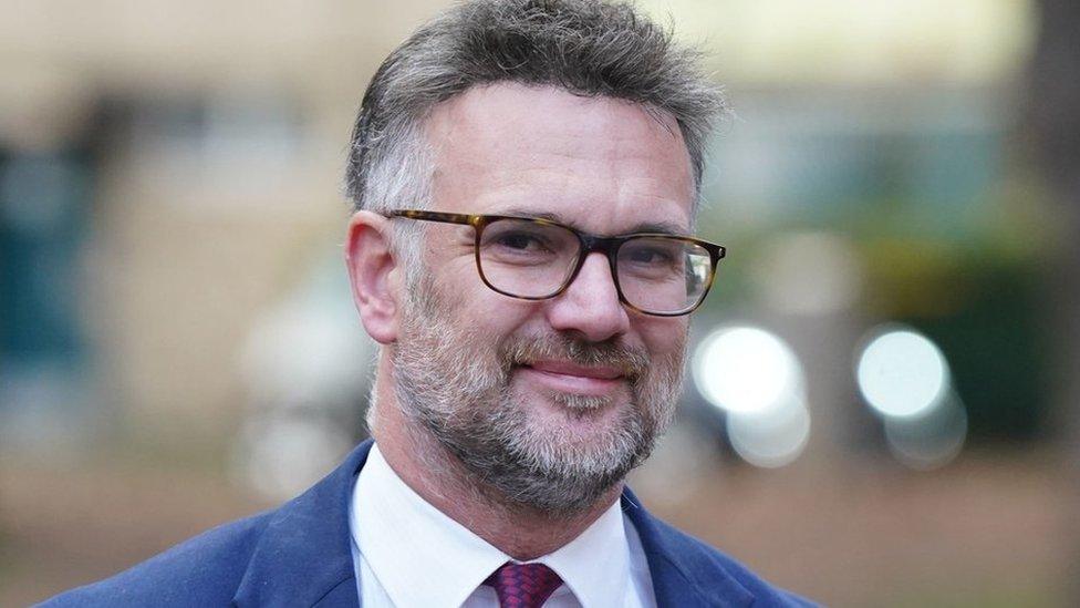Charles Hanson Hair Transplant