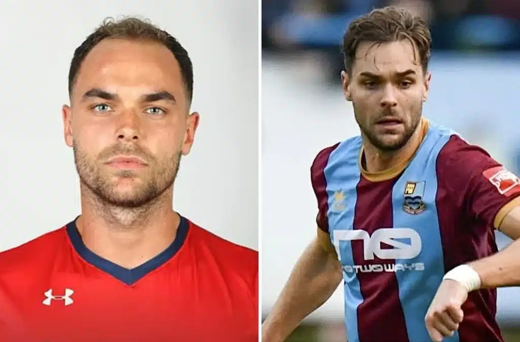 Love Island Hair Transplant: Harry Cooksley’s Transformation and What It Teaches About Modern Hair Restoration