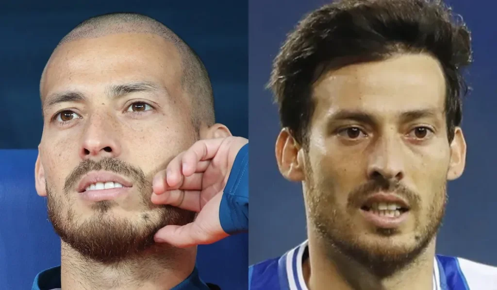 David Silva Hair Transplant: Everything We Know